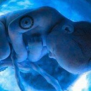 Meet your Posher, Antonio